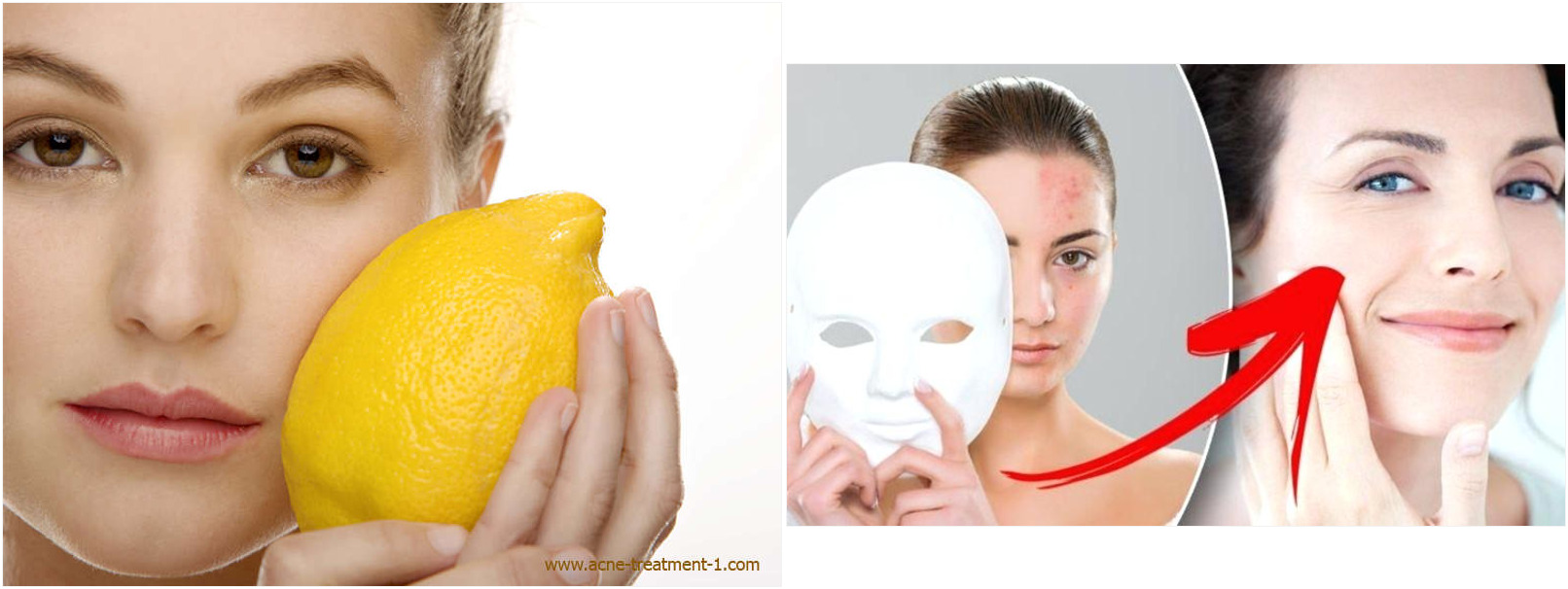 toallitas acne 125