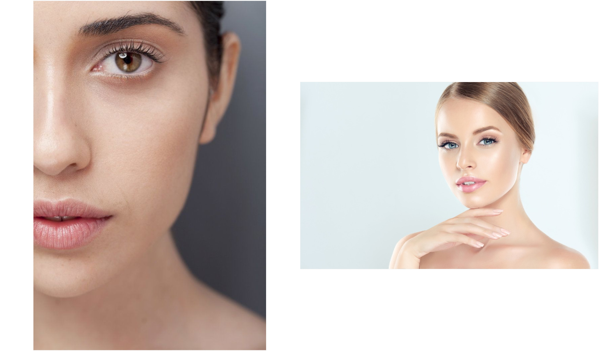 toallitas acne 205