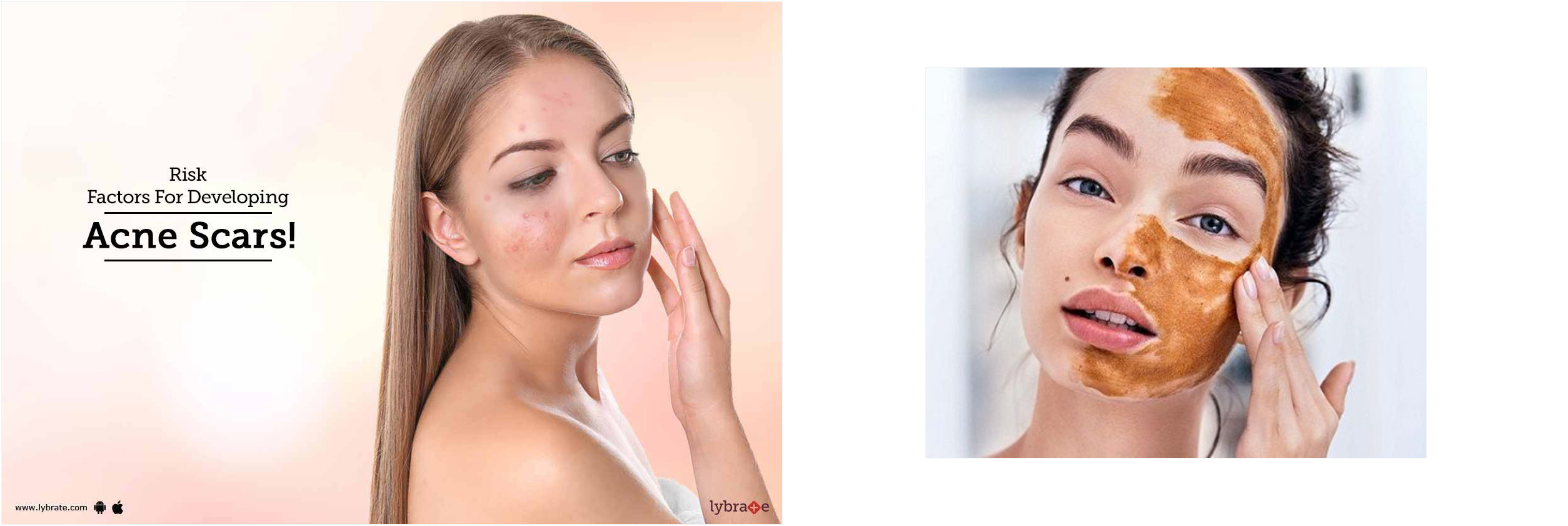 toallitas acne 3