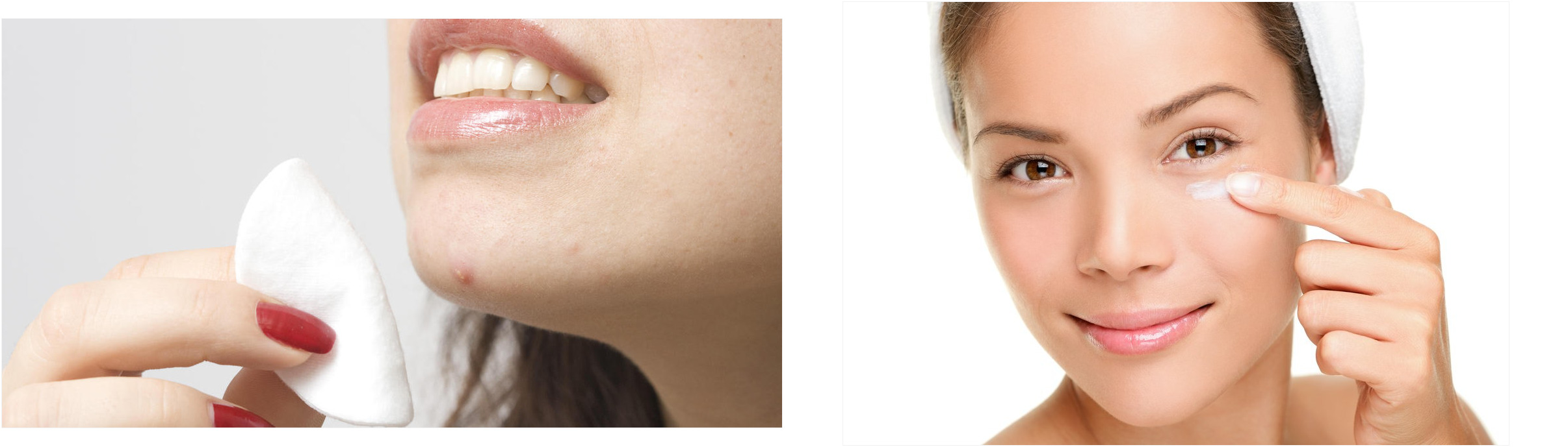toallitas acne 81