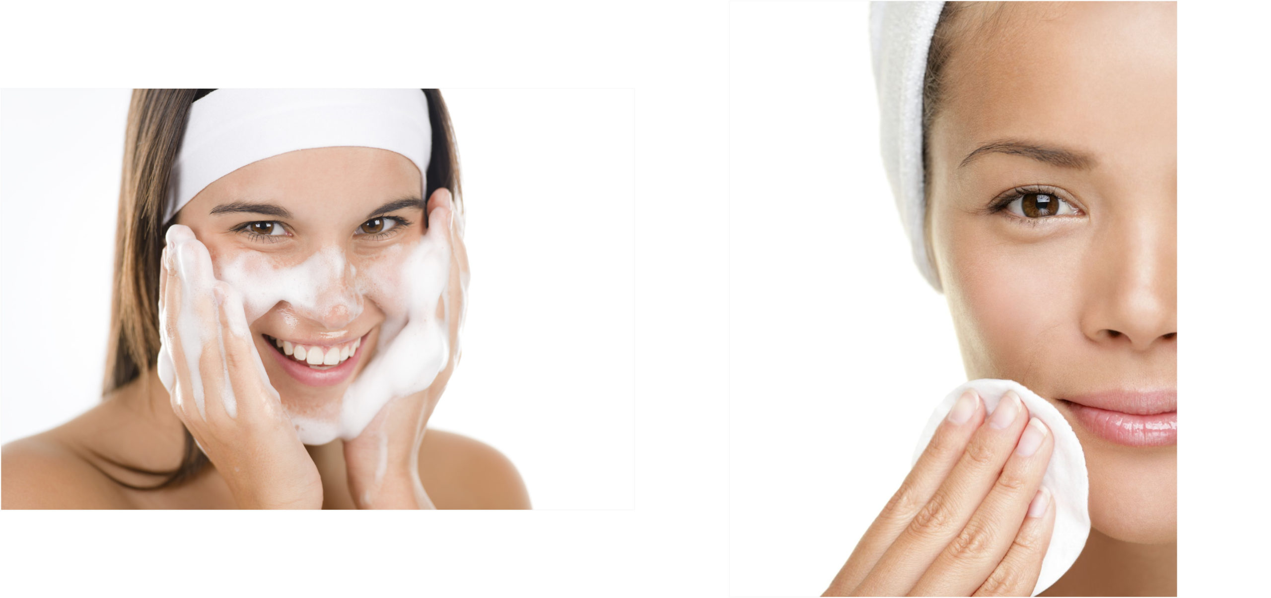 toallitas acne 87